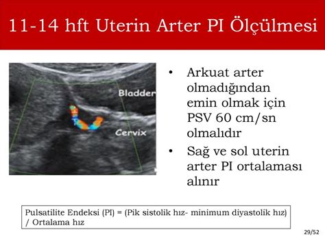 sağ uterin arter kaç olması lazım